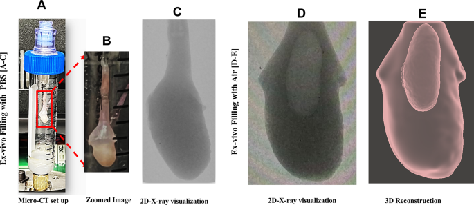 Elucidating the high compliance mechanism by which the urinary bladder fills under low pressures