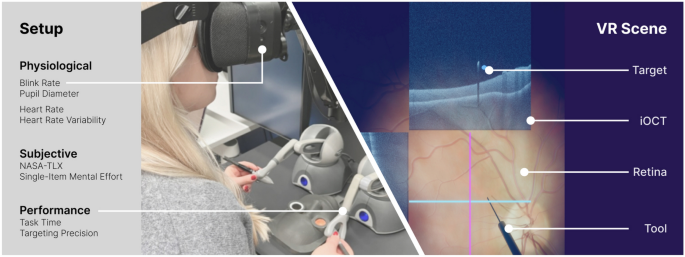 The impact of intraoperative optical coherence tomography on cognitive load in virtual reality vitreoretinal surgery training