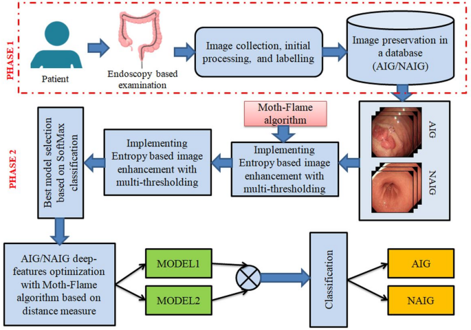 Autoimmune gastritis detection from preprocessed endoscopy images using deep transfer learning and moth flame optimization