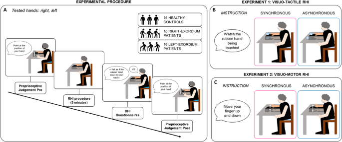 Distinct patterns of visuo-tactile and visuo-motor body-related integration in Parkinson’s disease