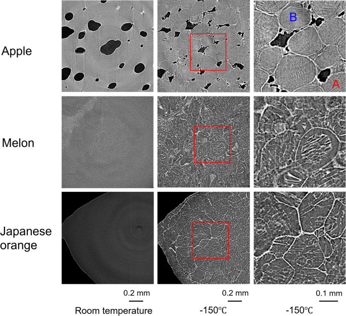 Fine visualization of biological cells using X-ray micro-CT with the slow freezing contrast improved method