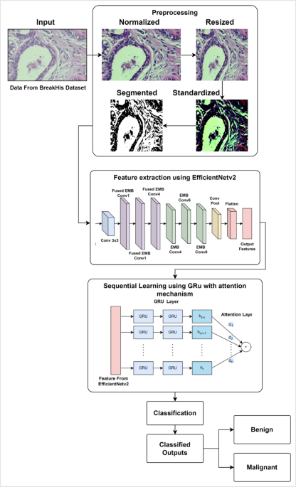 A hybrid deep learning model EfficientNet with GRU for breast cancer detection from histopathology images