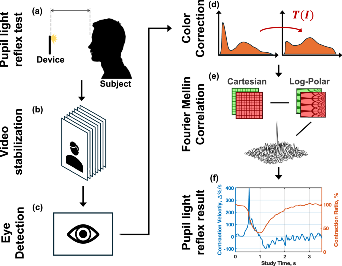 Video-based pupillometry using Fourier Mellin image correlation