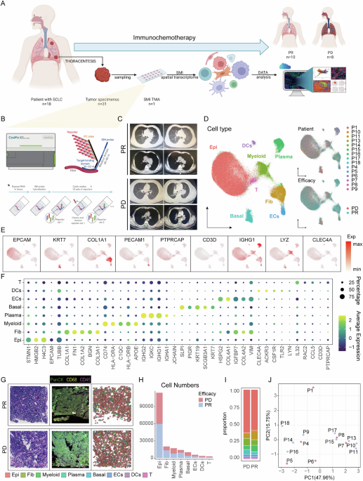 Spatial transcriptomics reveals macrophage domestication by epithelial cells promotes immunotherapy resistance in small cell lung cancer