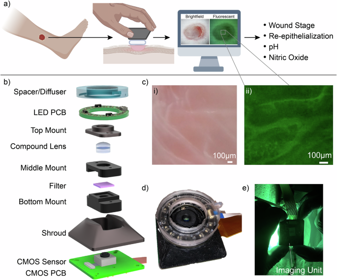 A modular fluorescent camera unit for wound imaging