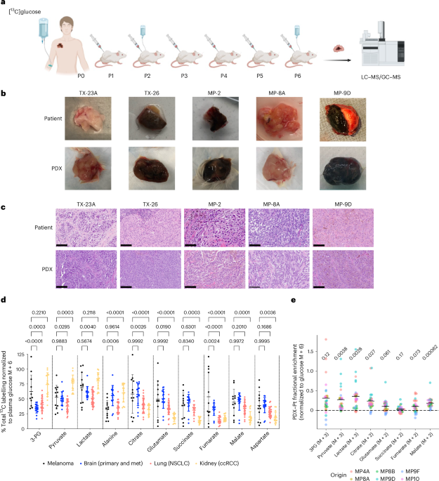 Conservation and divergence of metabolic phenotypes between patient tumours and matched xenografts