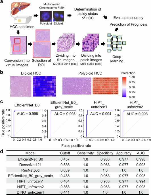Selective identification of polyploid hepatocellular carcinomas with poor prognosis by artificial intelligence-based pathological image recognition