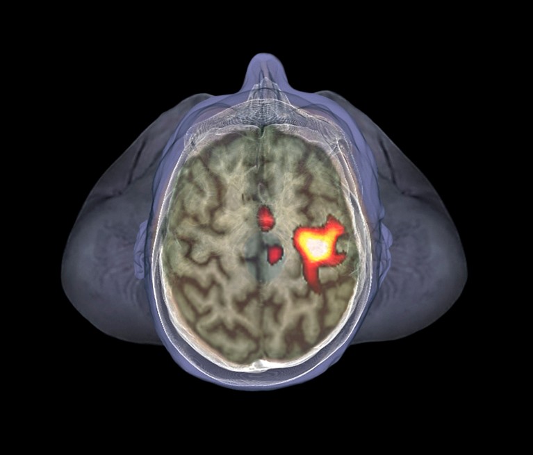 The brain fires up immune cells when sick people are nearby