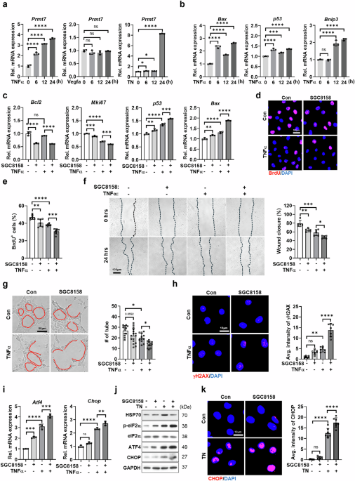 Endothelial PRMT7 prevents dysfunction, promotes revascularization and enhances cardiac recovery post-myocardial infarction