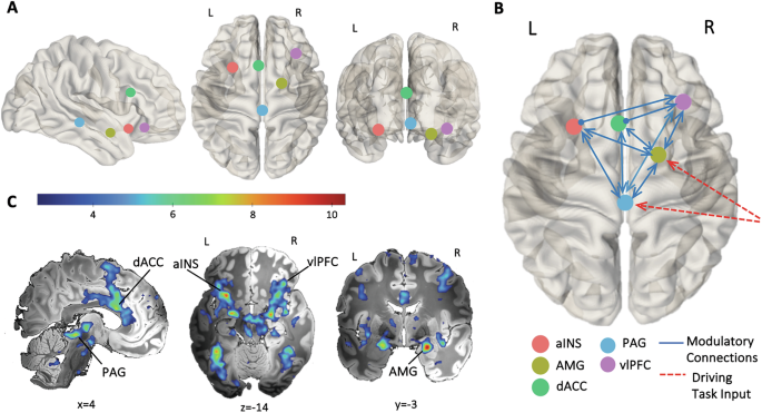 Subcortical modulation of the salience network during negative emotional processing in mood and anxiety disorders