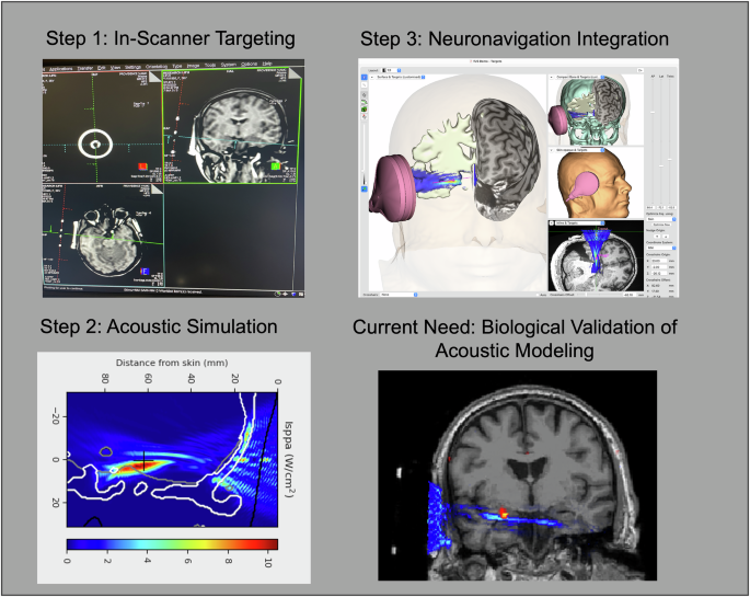 Quiet waves, deep impact: acoustic modeling of low-intensity focused ultrasound