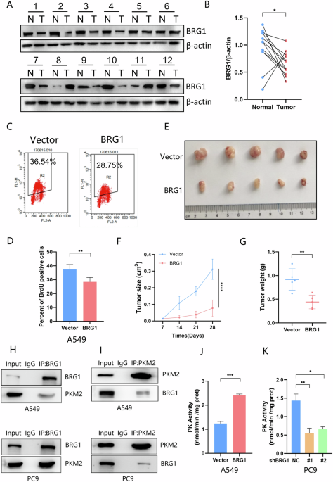 BRG1 inhibits glycolysis by promoting SHP1-mediated dephosphorylation of PKM2 in non-small cell lung cancer