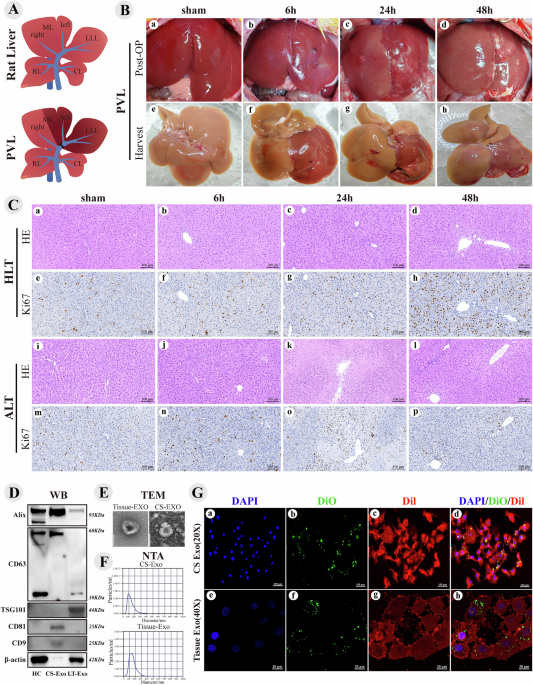 Exosomes from liver progenitor cells carrying JAG1 activate notch signaling to promote liver regeneration in PVL rats
