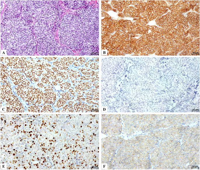 Lead bioaccumulation in human breast cancer tissue is associated with DNA instability and cell death resistance