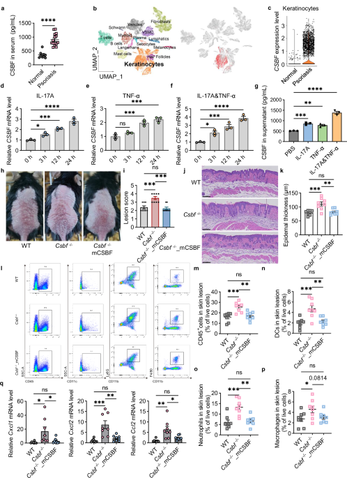 The cytokine CSBF inhibits the IL-17A and TNF-α inflammatory pathways via SUSD2-ACT1 in keratinocytes and alleviates IMQ-induced psoriasis