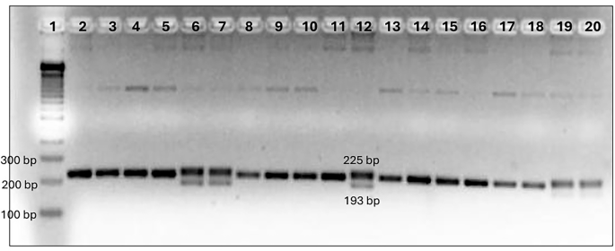 Distribution of CCR5-Δ32 and HLA-B*57:01 alleles in HIV-seropositive and HIV-exposed seronegative Peruvian individuals