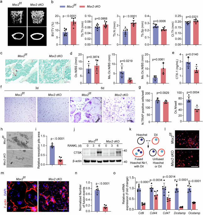 Targeting Msx2 as a brake in the fusion fate of osteoclasts and an anabolic therapy in pre-clinical models of osteoporosis