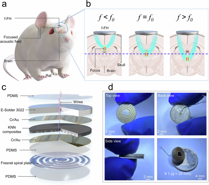 KNN-based frequency-adjustable ferroelectric heterojunction and biomedical applications