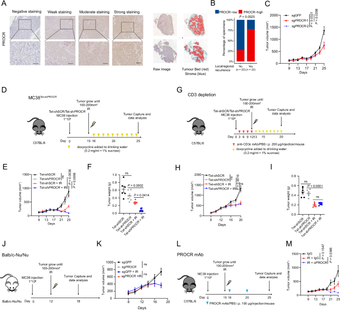 PROCR diminishes the efficacy of radiation by impairing T-cell-mediated antitumour immunity