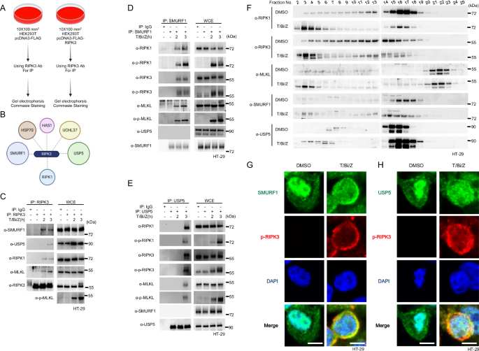 Opposing regulation of the K63-linked polyubiquitination of RIPK3 by SMURF1 and USP5 in necroptosis