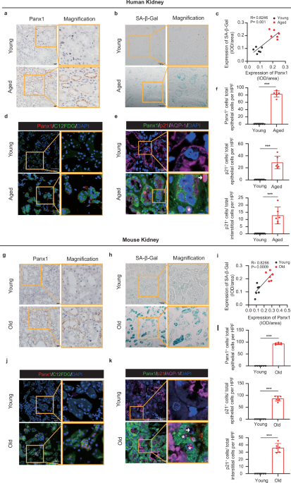 Noncanonical function of Pannexin1 promotes cellular senescence and renal fibrosis post-acute kidney injury