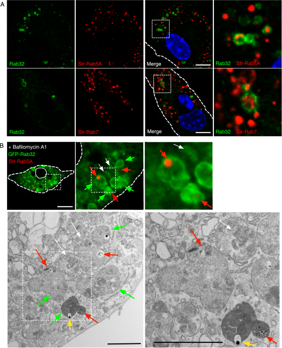 Evidence that mitochondria in macrophages are destroyed by microautophagy