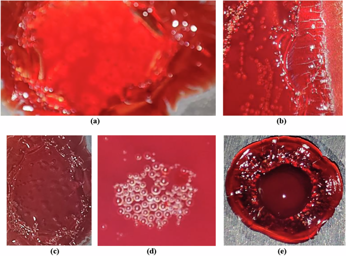 In vitro evidence of bubble-induced acoustic softening and Sanal flow choking in cardiovascular decompression