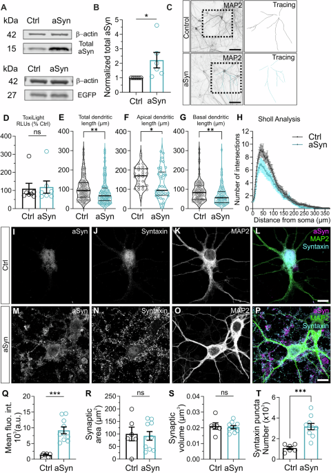 Glutamatergic synaptic resilience to overexpressed human alpha-synuclein