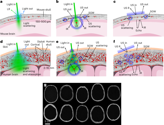 Imaging the brain by traversing the skull with light and sound