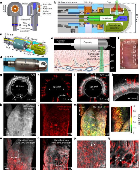 Tethered optoacoustic and optical coherence tomography capsule endoscopy for label-free assessment of Barrett’s oesophageal neoplasia