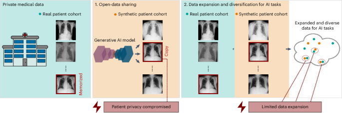 Unconditional latent diffusion models memorize patient imaging data