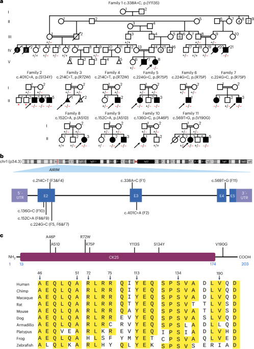 A programmed decline in ribosome levels governs human early neurodevelopment
