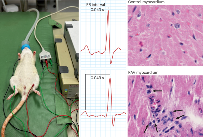 A transformative preclinical model of rheumatic heart disease