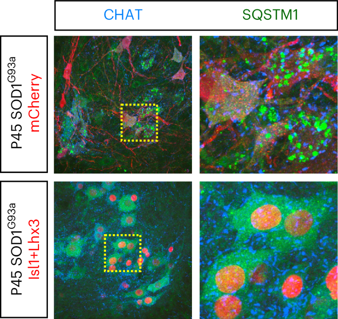 Turning back the clock on age-related neurodegeneration
