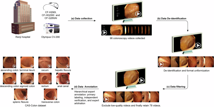 CAS-Colon: A Comprehensive Colonoscopy Anatomical Segmentation Dataset for Artificial Intelligence Development