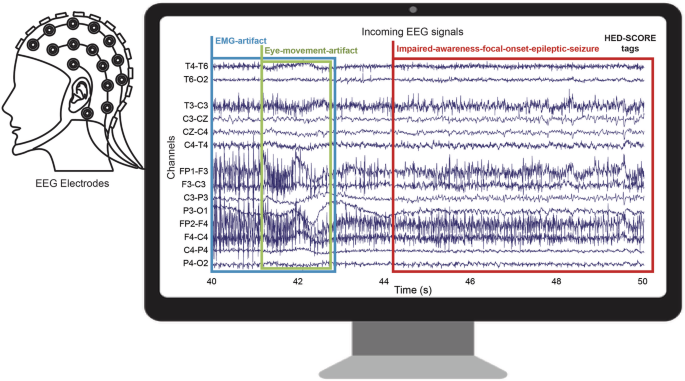 Hierarchical Event Descriptor library schema for EEG data annotation