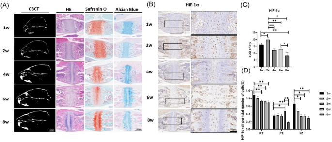 HIF-1α regulates the proliferation and differentiation of mouse cranial base sphenoid-occipital synchondrosis chondrocytes via PI3K/Akt signaling