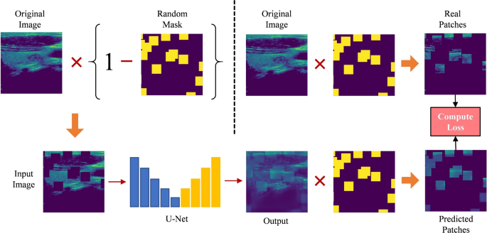 Masked pretraining of U-Net for ultrasound image segmentation