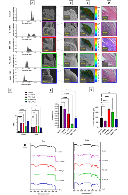 Evaluating the impact of contrast agents on micro and nano mechanics of soft-to-hard tissue interface