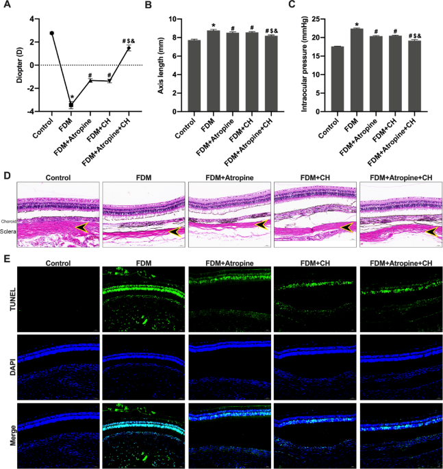 0.01% atropine combined with carteolol hydrochloride can inhibit the scleral remodeling in guinea pigs with form-deprivation myopia