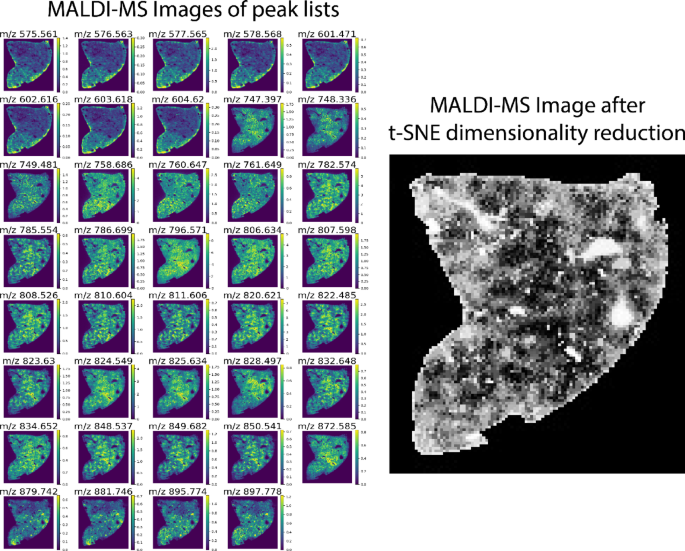 Novel feature-based method for multi-modal biomedical image registration compared to intensity-based technique