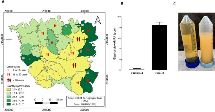 Pesticide exposome reveals oxidative stress and immune response disruptions in occupationally exposed women with breast cancer