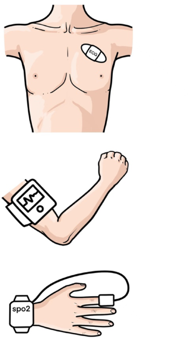 Comparison of consistency between wireless and conventional wired monitoring systems in gastrointestinal endoscopy