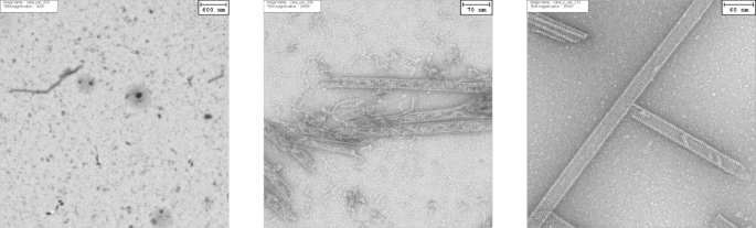 Biophysical characterization and solution structure of the cannulae-forming protein CanA from the hyperthermophilic archaeon Pyrodictium abyssi