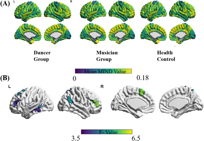 Shared and distinct patterns of cortical morphometric inverse divergence and their association with empathy in dancers and musicians