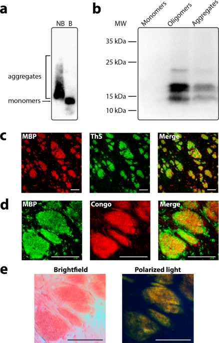 Amyloid fibrils of the myelin basic protein are an integral component of myelin in the vertebrate brain