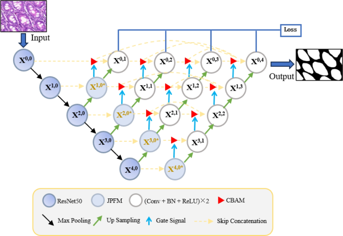 Multi-module UNet++ for colon cancer histopathological image segmentation