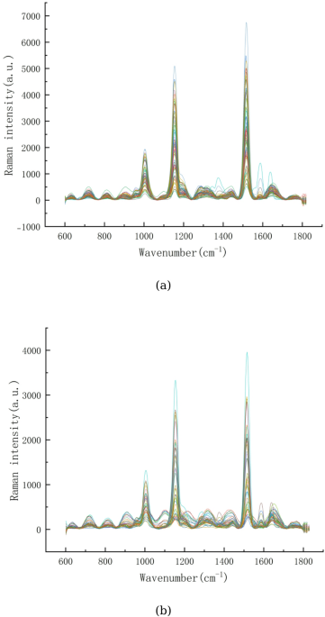 A novel approach to smart-assisted schizophrenia screening based on Raman spectroscopy and deep learning