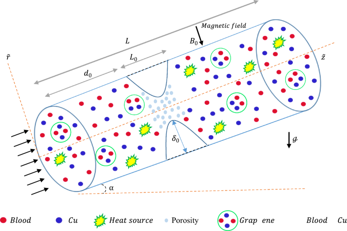 Mathematical modeling of blood flow with copper and graphene nanoparticles in inclined stenotic arteries