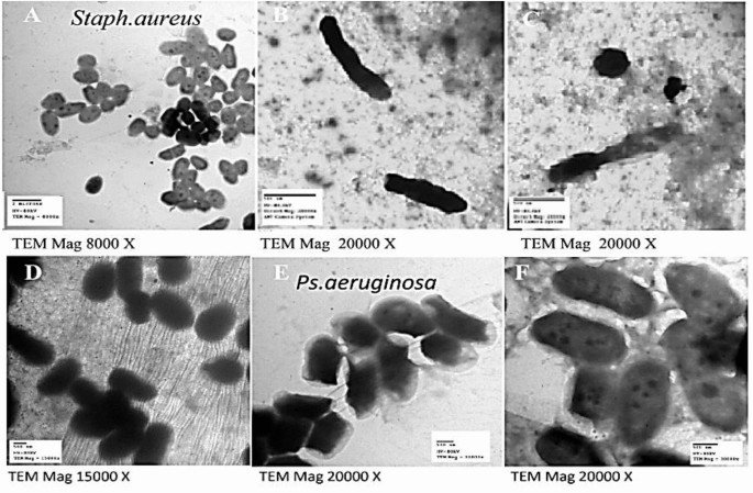 Biological activities and application of Rosmarinus officinalis extract to improve the preservation and microbial qualities of some local meat products